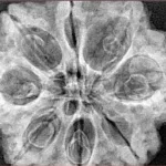 8 Mukhi Rudraksha 31.6mm 7.94gm - Origin: Nepal - Inverse xray