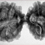 12 MK Gaurishankar 41.1mm 8.65gm - Inverse xray