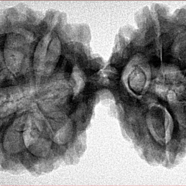12 MK Gaurishankar 41.1mm 8.65gm - Inverse xray