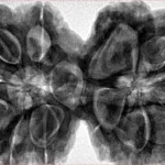 12 MK Gaurishankar 43.3mm 12.51gm - Inverse xray