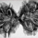 10 Mk Gaurishankar 40.2mm 7.63gm - Inverse xray