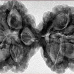 9 MK Gaurishankar 39.5mm 8.67gm - Inverse xray