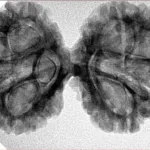 8 MK Gaurishankar 37.9mm 6.08gm - Inverse xray