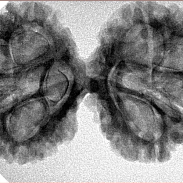 8 MK Gaurishankar 37.9mm 6.08gm - Inverse xray