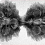 10 Mk Gaurishankar 41.8mm 8.76gm - Inverse xray