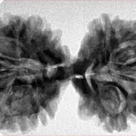 9 MK Gaurishankar 37.4mm 6.79gm - Inverse xray