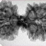 10 Mk Gaurishankar 37.8mm 6.71gm - Inverse xray