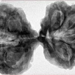 9 MK Gaurishankar 42.2mm 10gm - Inverse xray
