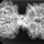 10 Mk Gaurishankar 37.8mm 6.71gm - Xray