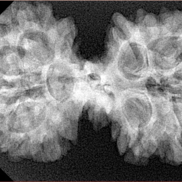 10 Mk Gaurishankar 37.8mm 6.71gm - Xray