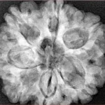7 Mukhi Rudraksha 28.8mm 7.38gm - Xray