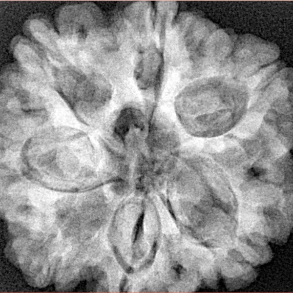 7 Mukhi Rudraksha 28.8mm 7.38gm - Xray