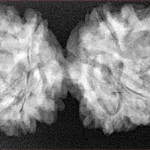 9 MK Gaurishankar 40.4mm 7.4gm - Xray