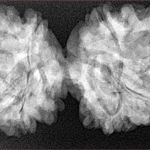 9 MK Gaurishankar 40.4mm 7.4gm - Xray