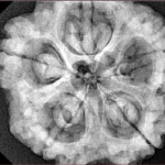 5 Mukhi Rudraksha 30.1mm 8.08gm - Xray