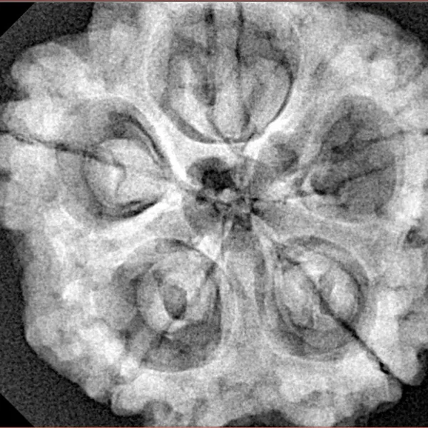 5 Mukhi Rudraksha 30.1mm 8.08gm - Xray