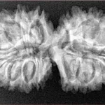 19 MK Gaurishankar 36mm 5.69gm - Xray