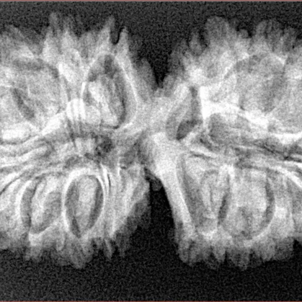 19 MK Gaurishankar 36mm 5.69gm - Xray