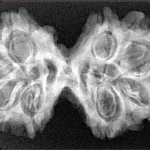 8 MK Gaurishankar 36.5mm 5.8gm - Xray