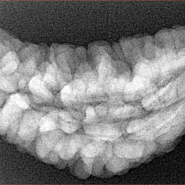 1 Mukhi Rudraksha 34.8mm 4.87gm - Xray