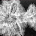 15 Mukhi Garbh Gauri 40.1mm 8.76gm - Xray