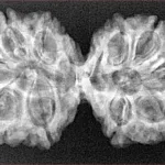 10 Mk Gaurishankar 37mm 5.59gm - Xray