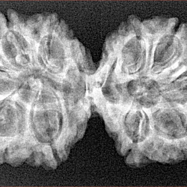 10 Mk Gaurishankar 37mm 5.59gm - Xray