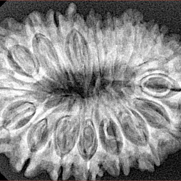 18 Mukhi Rudraksha 31.9mm 5.28gm - Xray