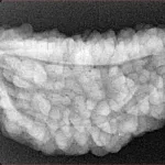 1 Mukhi Rudraksha 33.8mm 5.89gm - Xray
