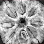 8 Mukhi Rudraksha 32.4mm 8.68gm - Xray