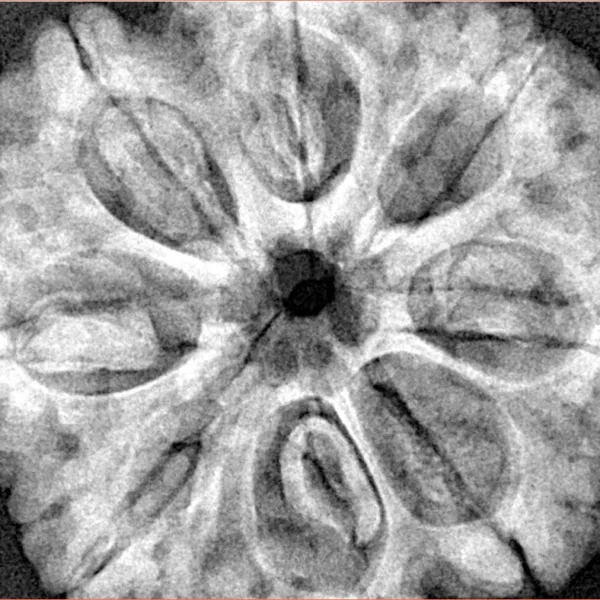 8 Mukhi Rudraksha 32.4mm 8.68gm - Xray