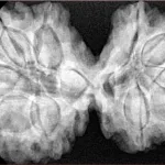 10 Mk Gaurishankar 39.4mm 9.2gm - Xray
