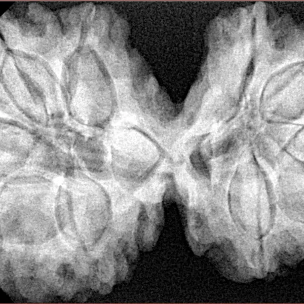 10 Mk Gaurishankar 39.4mm 9.2gm - Xray