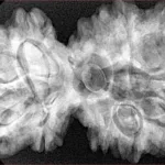 10 Mk Gaurishankar 40.1mm 9.31gm - Xray