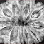 11 Mukhi Rudraksha 34.6mm 9gm - Xray