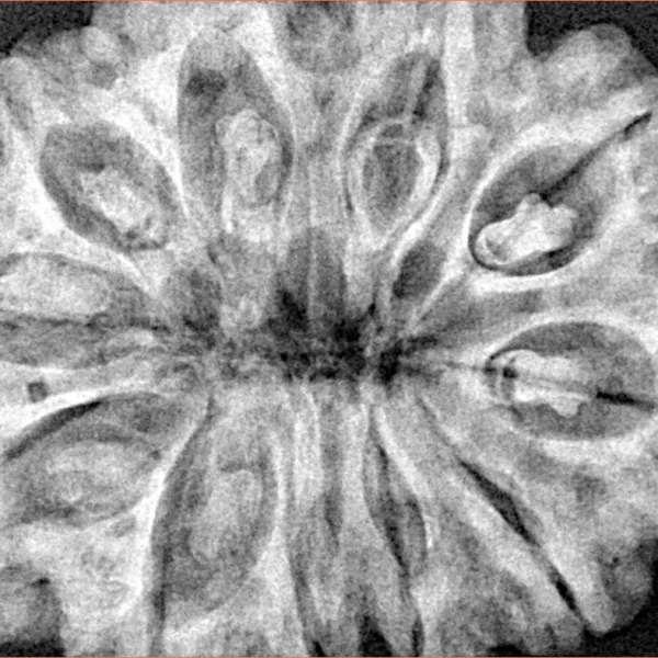 11 Mukhi Rudraksha 34.6mm 9gm - Xray