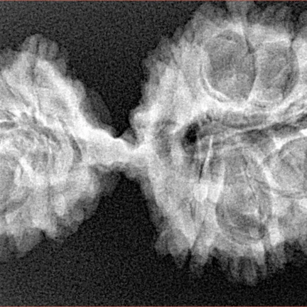 19 MK Gaurishankar 39.1mm 5.49gm - Xray