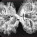 9 MK Gaurishankar 37.9mm 7.17gm - Xray