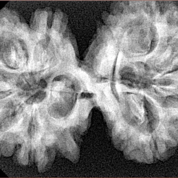 9 MK Gaurishankar 37.9mm 7.17gm - Xray