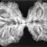 10 Mk Gaurishankar 40.5mm 7.85gm - Xray