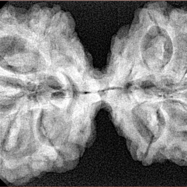 10 Mk Gaurishankar 40.5mm 7.85gm - Xray