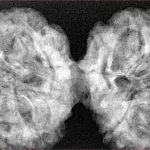 9 MK Gaurishankar 43.6mm 10gm - Xray