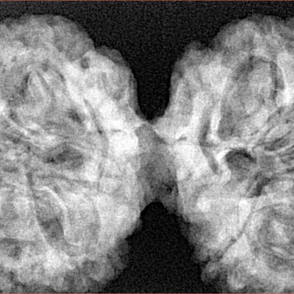 9 MK Gaurishankar 43.6mm 10gm - Xray