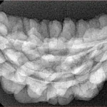 1 Mukhi Rudraksha 38.7mm 5.59gm - Xray