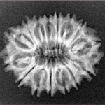 15 Mukhi Rudraksha 24.7mm 2.8gm - Xray