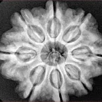 8 Mukhi Rudraksha 28.2mm 6.36gm - Xray