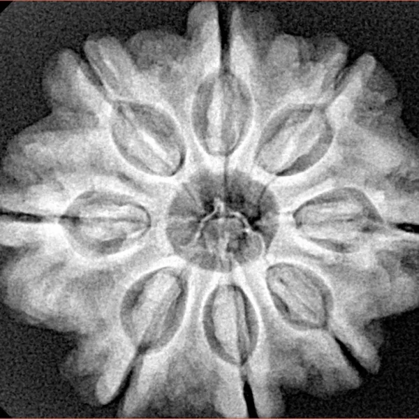 8 Mukhi Rudraksha 28.2mm 6.36gm - Xray
