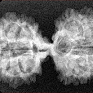 18 Mukhi Gaurishankar 39.6mm 5.71gm - Xray