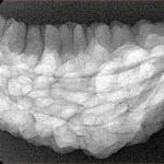 1 Mukhi Rudraksha 38.9mm 6.07gm - Xray
