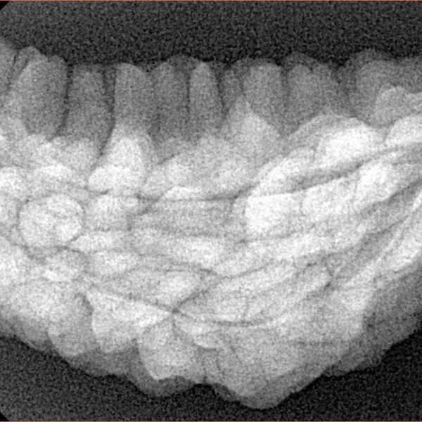 1 Mukhi Rudraksha 38.9mm 6.07gm - Xray